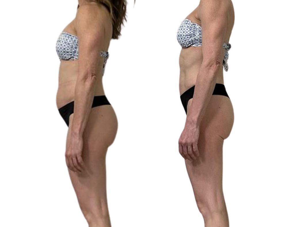 Client transformation